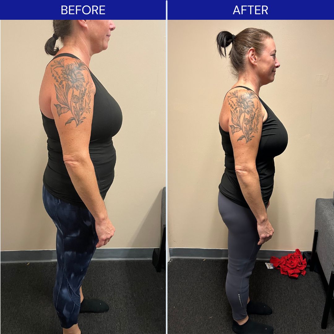weight loss st pete